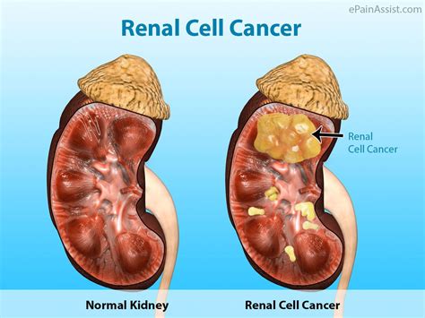 Pin on Abdominal Pain or Stomach Pain