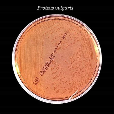 Morphology & Culture Characteristics of Proteus Vulgaris