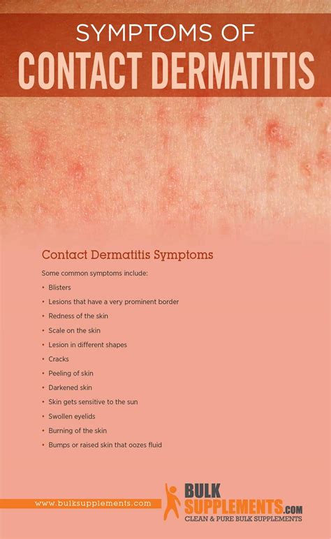 Tablo | Read 'Contact Dermatitis: Symptoms, Causes & Treatment' by