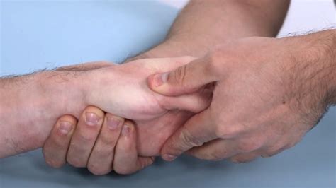 Adduction Test | Carpometacarpal 1 Osteoarthritis | Thumb OA