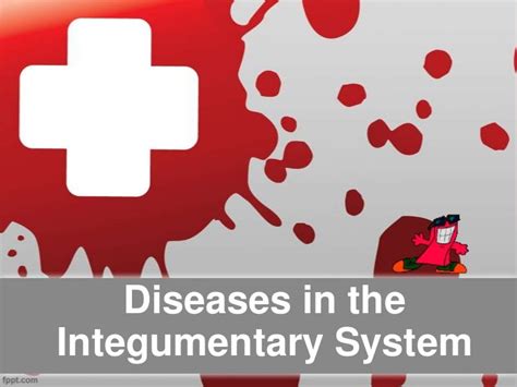 Integumentary system diseases