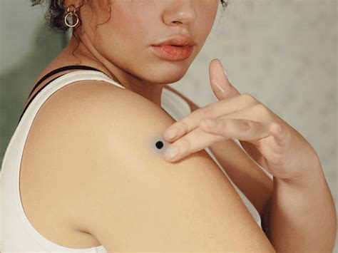 What to Know If Your Weird Mole Turns Out to Be a Blue Nevus