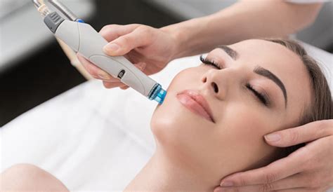 Why Microdermabrasion is Good for Your Skin? - The Fashiongton Post