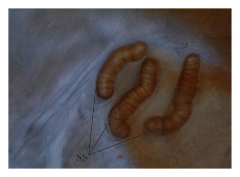 Posterior end of Cordylobia anthropophaga larvae with two posterior... | Download Scientific Diagram