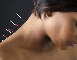 Acupuncture For Lower Back Pain Kerry Acupuncture