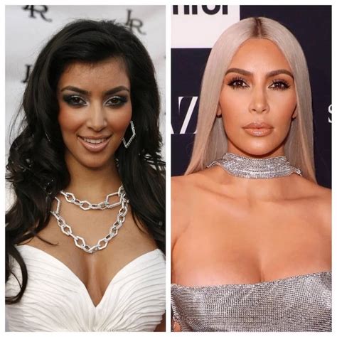 Kim Kardashian's Plastic Surgery Journey - Vanity