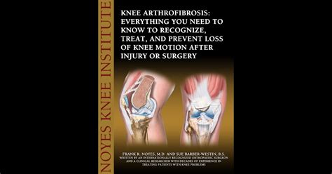 Knee Arthrofibrosis: Everything You Need to Know to Recognize, Treat, and Prevent Loss of Knee ...