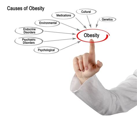 Diagram of Causes of Obesity — Stock Photo © vaeenma #152371898