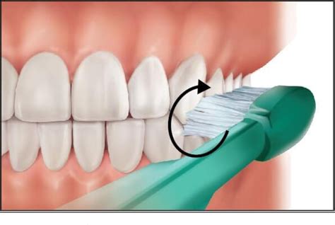 Figure 2 from Causes laceration of the gingiva 2 ) Modified Bass Method / Sulcus Cleaning Method ...