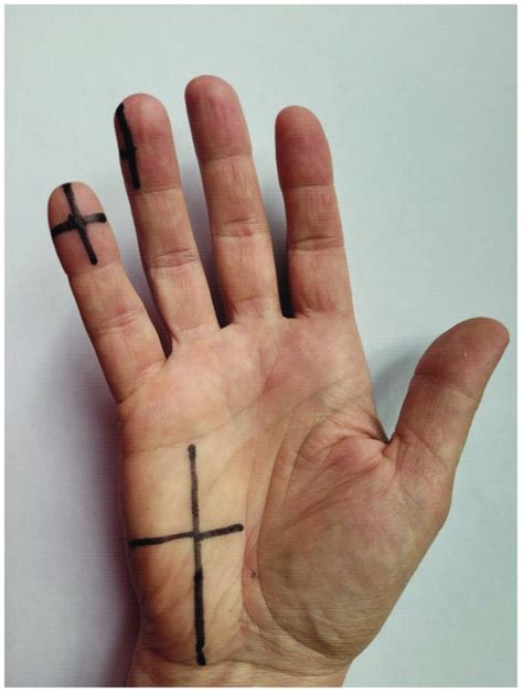 Longitudinal and transverse lines to standardize the measurements. | Download Scientific Diagram