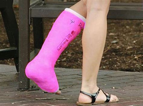 Cast Kit - Short Leg - Fiberglass - A-1 Medical Integration