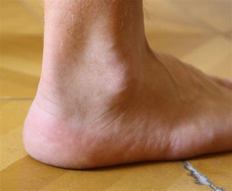 檔案:Ankle.jpg - 自由編輯个維基百科