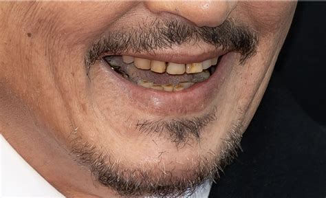 Johnny Depp’s teeth visibly rotting, fans react in disgust