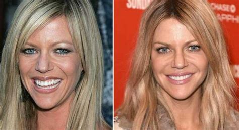 Did Kaitlin Olson Undergo Plastic Surgery Including Boob Job and Nose Job? - Famous Plastic ...