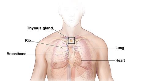 Advanced and recurring thymic carcinoma is target of new clinical trial | Center for Cancer Research