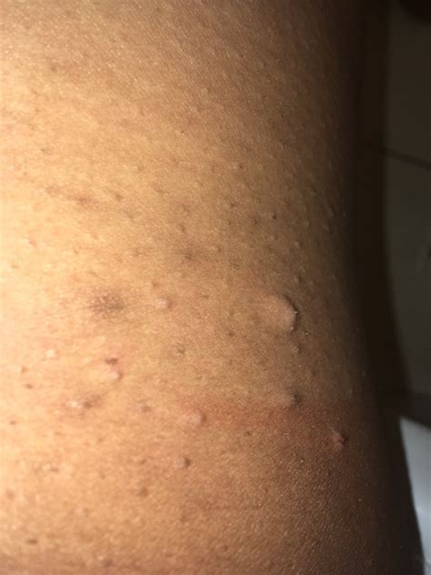 i know it’s pretty gross looking but i’m wondering what these weird ...