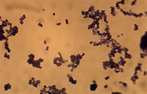 Micrococcus - microbewiki