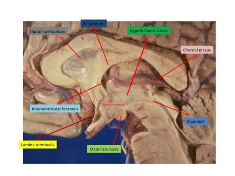 Anatomy of hypothalamus n limbic system