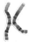 Chromosome 1 - Wikipedia