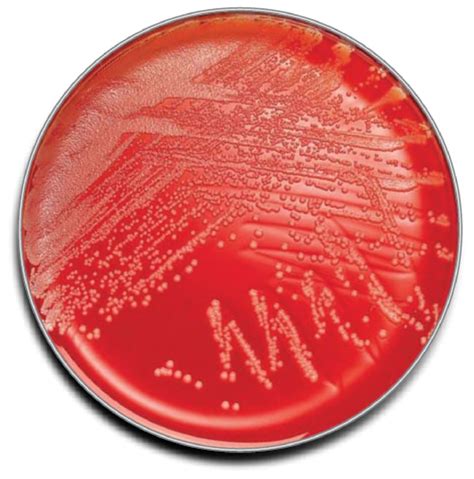 BD BBL Prepared Plated Media: Columbia Agar with 5% Sheep Blood 100/Pk ...