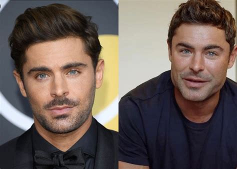 Zac Efron's new face: Actor explains why he had surgery [watch]