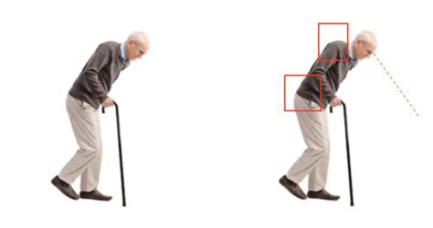 Senior Tips: Using a Cane Correctly