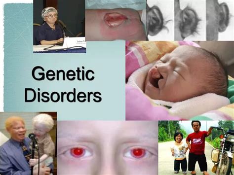 PPT - Genetic Disorders PowerPoint Presentation, free download - ID:6904890