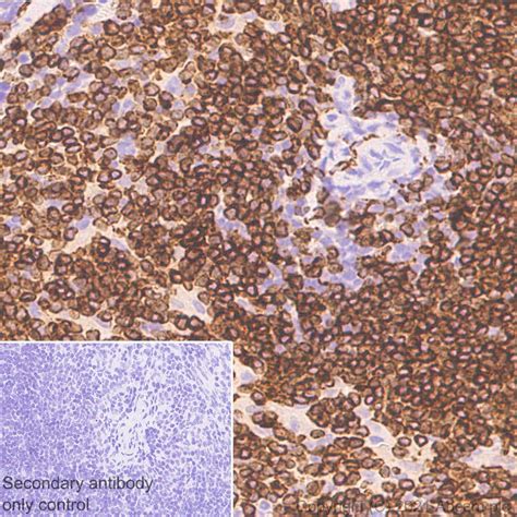 Recombinant Anti-CD74 antibody [EPR25399-94] (ab289885) | Abcam