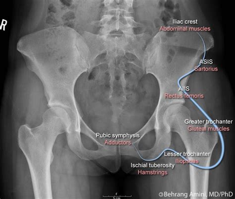 Asis Radiology