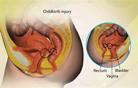 Health Condition : Symptoms, Causes, Treatment and More