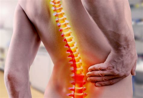 What is Lumbar Spondylosis, Symptoms and Treatment