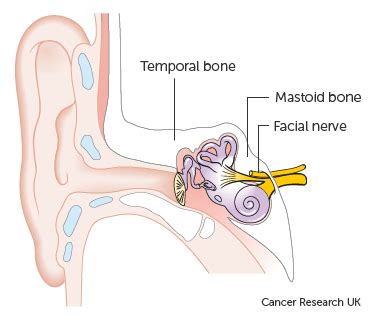 Tumours Of The Ear | SCENT