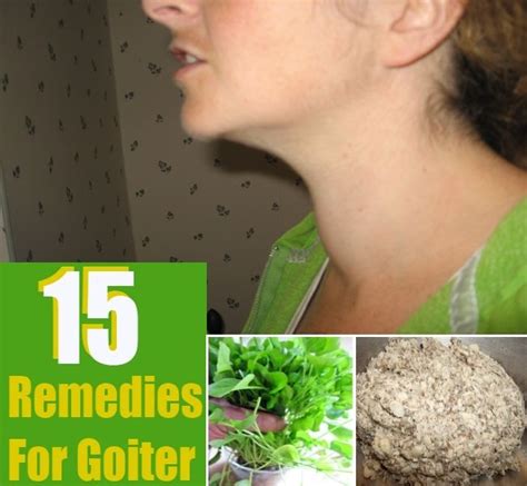 57 best images about Goiter on Pinterest | Thyroid treatment, Dandelion ...