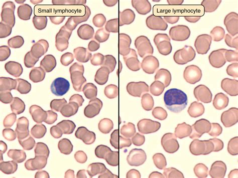 Lymphocytes Under Microscope