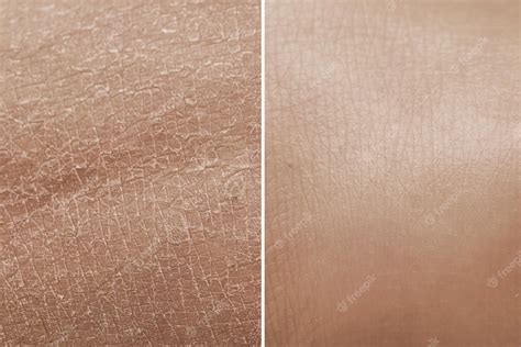 Premium Photo | Skin before and after a treatment with moisturizing ...