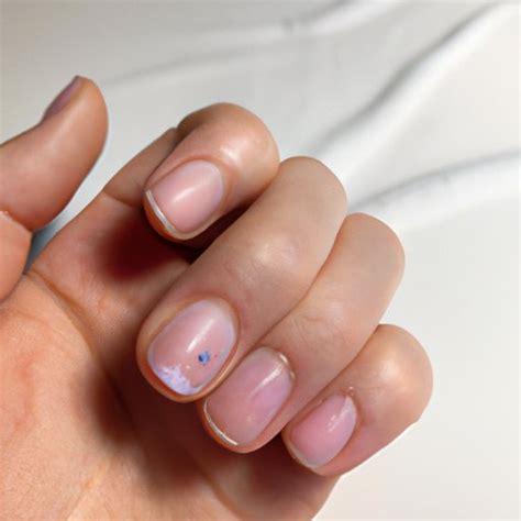 What is Nail Pitting? Overview, Symptoms, Causes and Treatments - The ...