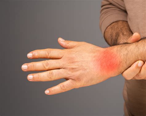 Understanding Rheumatoid Arthritis | Skin And Cancer Institute