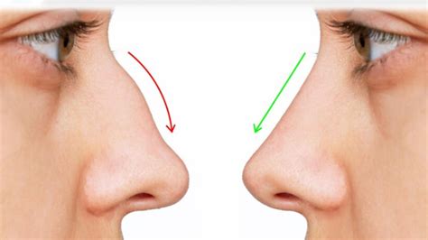 Understanding the Aquiline Nose: Features and Significance - Tumgazeteler