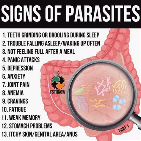 📗If you are in need of detailed guide how to get rid of all parasites (I personally have removed ...