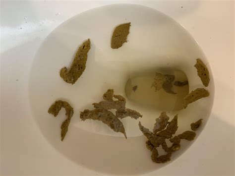 Warning Poop: does this look like fatty stool? Normal diet and fecal ...