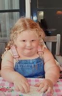 Ernstige obesitas bij kinderen heeft vaak medische oorzaak: ‘Ik ben ...