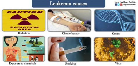 Leukemia - Blood Cancer