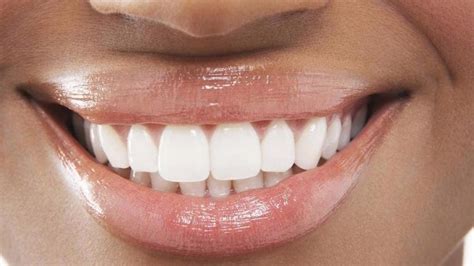 Vallejo Cosmetic Dentistry | 3 Options for a Beautiful Smile