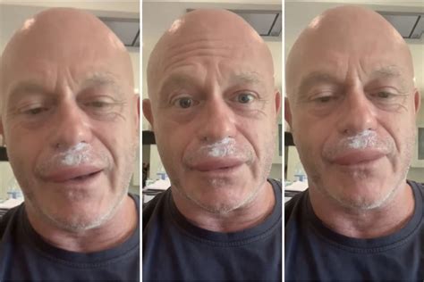 Ross Kemp thanks NHS after horrific wasp sting leaves him with swollen lip | London Evening ...