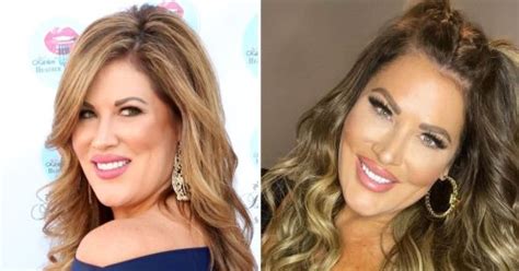 Did RHOC’s Emily Simpson Get Plastic Surgery? Facelift Announcement | Flipboard