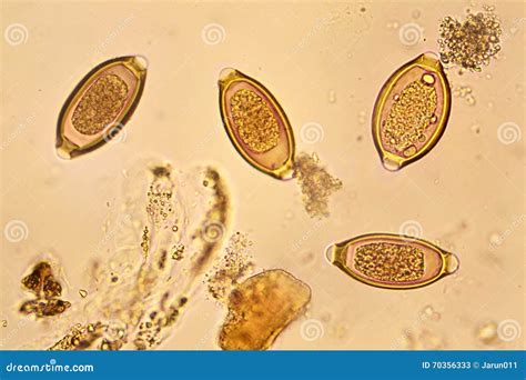 Trichuris Trichiura Royalty-Free Stock Photography | CartoonDealer.com #96910319