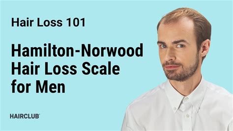Hamilton-Norwood Hair Loss Scale for Men - Male Pattern Baldness - YouTube