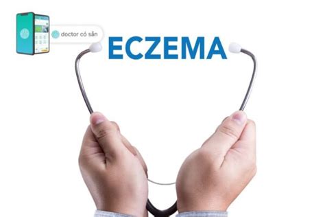 Eczema: Causes, symptoms and treatments | Doctor có sẵn