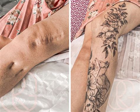 16 People Who Transformed Their Scars Into Pieces of Art / Bright Side