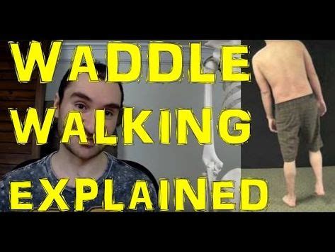 Waddling Gait: What Causes It & Exercises To Help Fix It | Shoulder ...